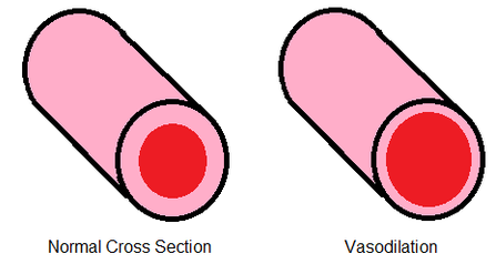 vasodilation